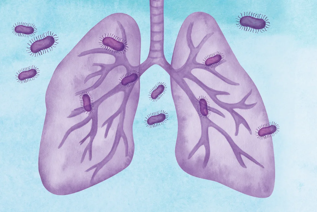 A Tuberculose Silenciosa: O Desafio de Combater uma Doença Histórica no Brasil