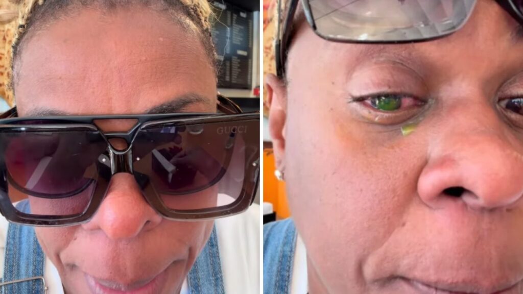 Pomadas Capilares: Risco de Cegueira Relacionado ao Uso Inadequado