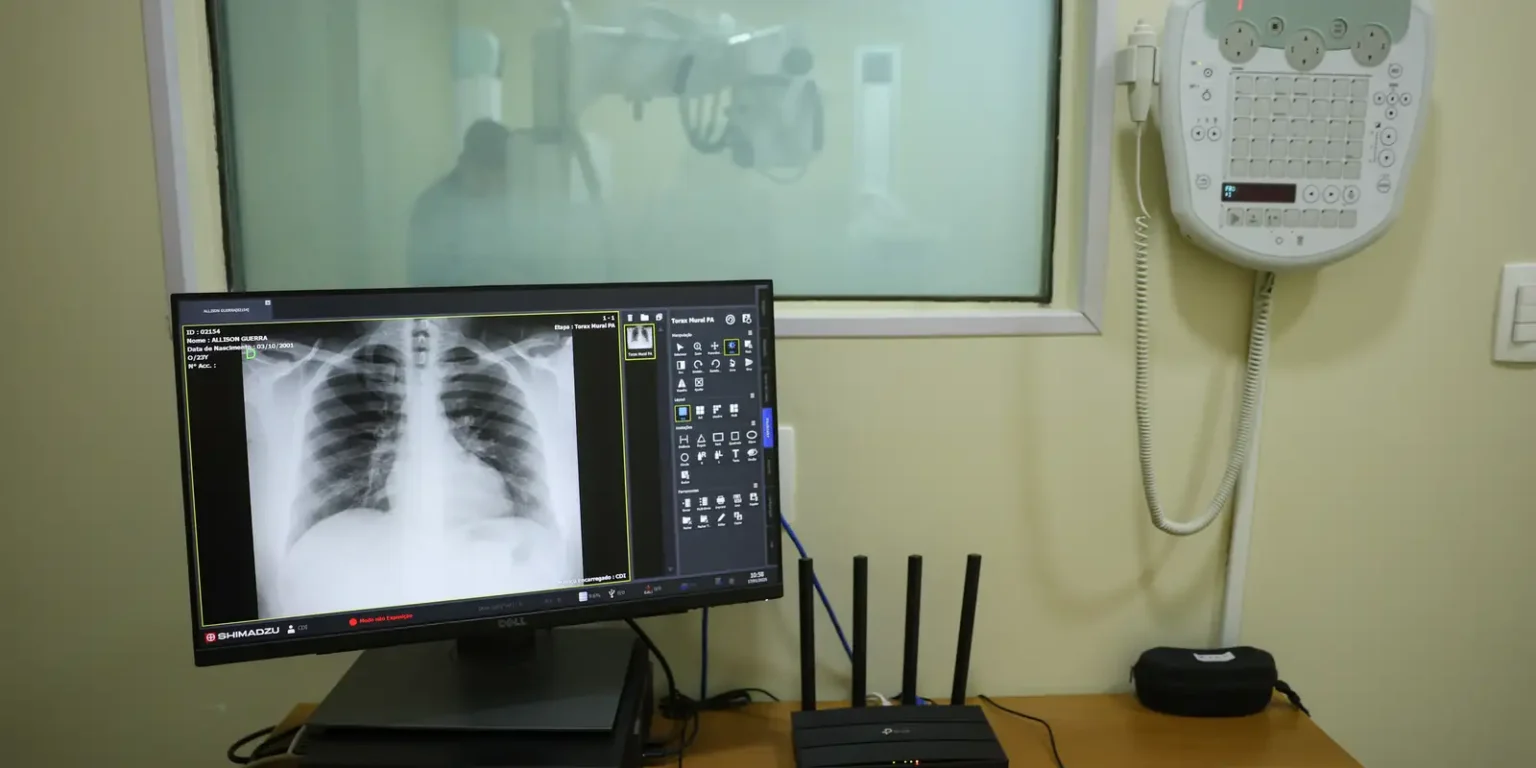 Nova Técnica Médica Promete Acelerar Recuperação de Fraturas Ósseas Nova Técnica Médica Promete Acelerar Recuperação de Fraturas Ósseas