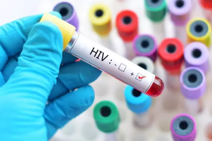 O Desafio da Ignorância sobre a Prevenção do HIV e o Uso de Medicamentos Inovadores